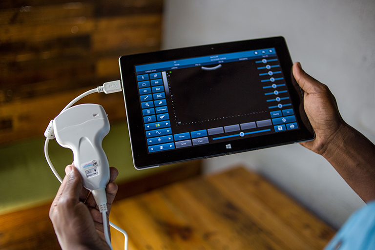 One of M-SCAN’s ultrasound scanners connected by a USB on-the-go cable to a computer tablet showing a scan readout on its screen